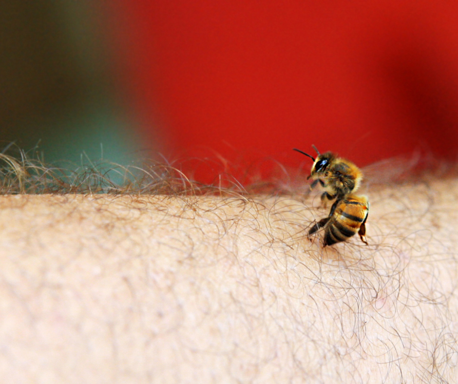 ตำรับยาบำบัดอาการแมลงกัดต่อย