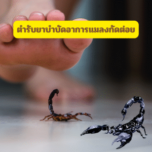 ตำรับยาบำบัดอาการแมลงกัดต่อย